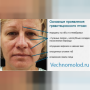 Гравитационный птоз