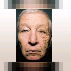 Фотостарение или как загар ускоряет старение кожи